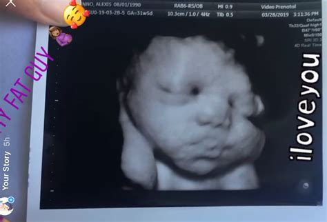 36 Weeks Pregnant Ultrasound 3d