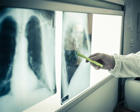 About EPPA — El Paso Pulmonary Association