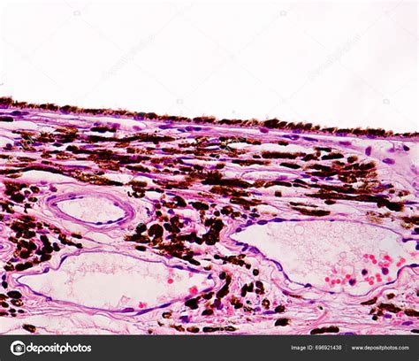 Light Micrograph Inner Layers Eyeball Showing Bottom Choroid Stroma Blood — Stock Photo ...