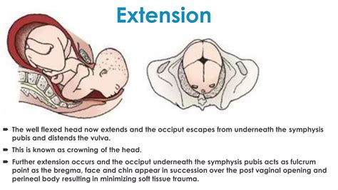 Mechanism of labor | PDF