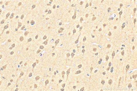 PYK2 antibody (17592-1-AP) | Proteintech
