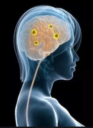 Ceftriaxone as effective as benzylpenicillin in managing neurosyphilis ...