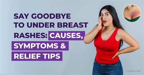 How To Treat Rash Under Breast: Remedies & Prevention Tips