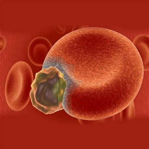 What are the important points to be considered in sepsis and septic shock?