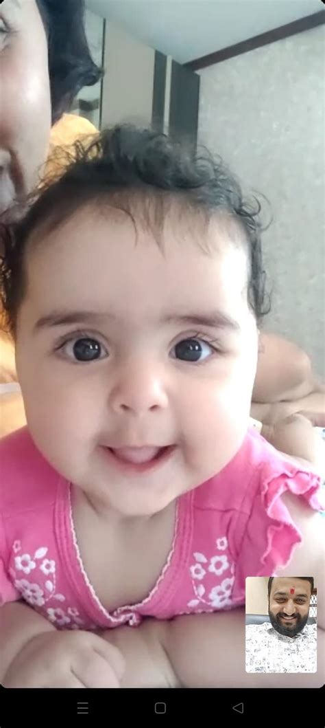 absent nasal bone | BabyCenter