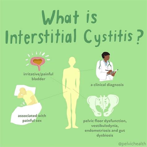 Understanding Interstitial Cystitis: What You Need to Know in 2025