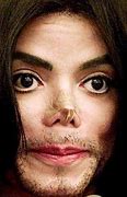 Image result for Michael Jackson Nose Prosthesis