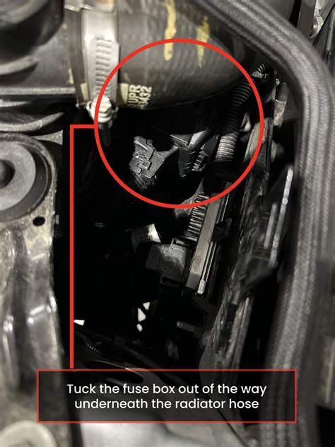 Image result for TCM Replacement