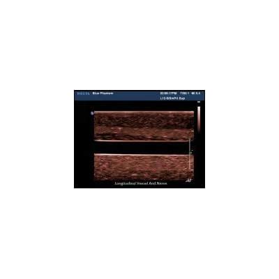 Blue Phantom Ultrasound Regional Anesthesia Training Model India | Ubuy