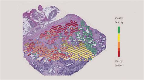 Spatial Transcriptome 的图像结果