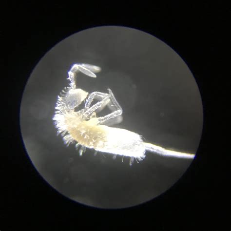 Image result for Spring Tails Bugs Under Microscope