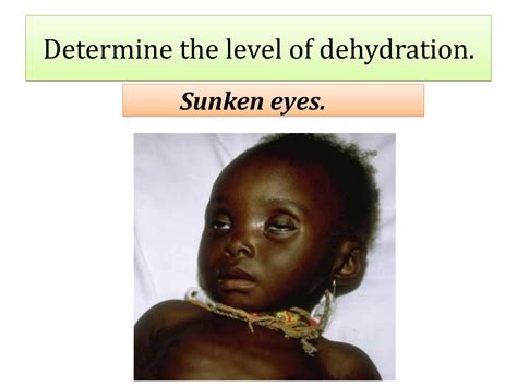 IMNCI: Diarrhoea | PPTX