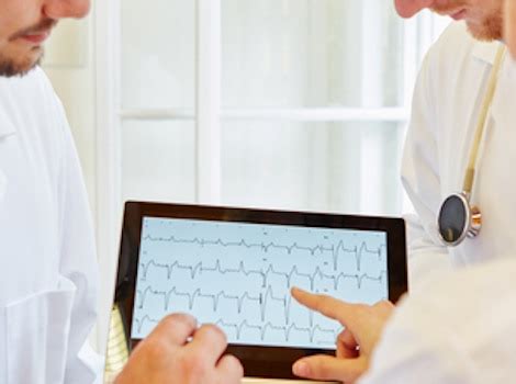 Cryptogenic Stroke and Underlying Atrial Fibrillation | GE HealthCare ...