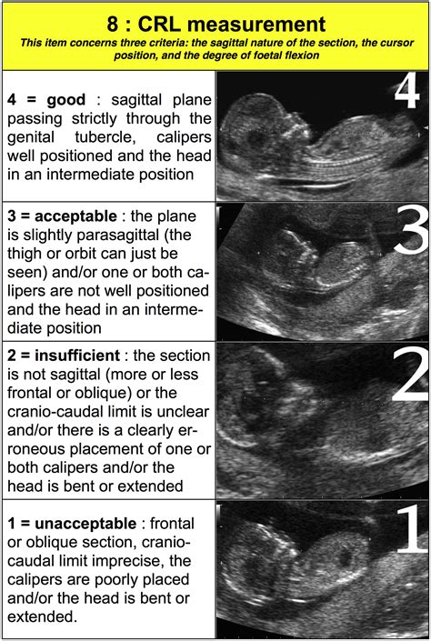 Crown Rump Length For 6 Weeks at Peggy Hodges blog