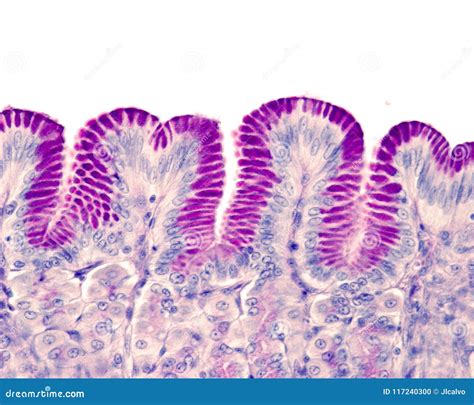 Periodic Acid Schiff Stain