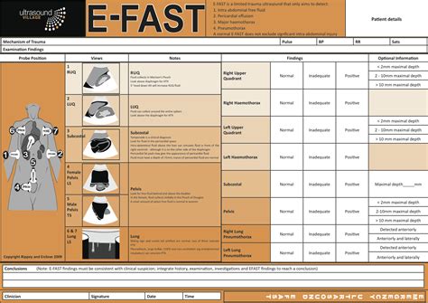 CME 18/2/16 - EFAST Examination - Charlie's ED