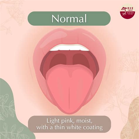 A TCM Physician’s Guide to Understanding Your Tongue - Eu Yan Sang TCM Clinic