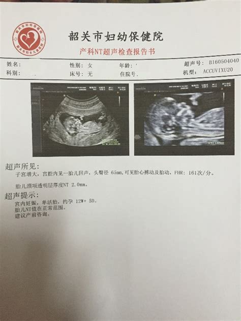 怀孕12周，有少量褐色分泌物，肚子微痛，B超显示未见胎芽 - 百度宝宝知道