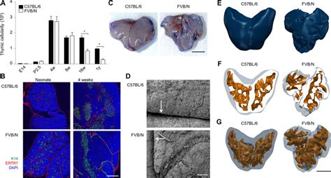 Image result for What Is Thymic Involution