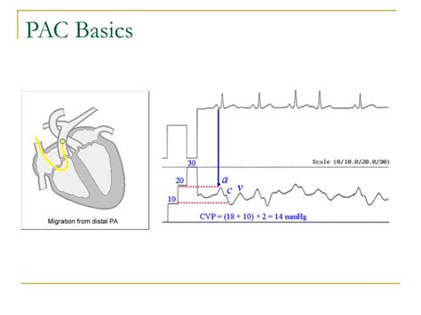 PAC Explained 的图像结果