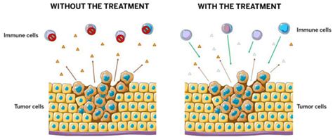 PEG-KYNase | Enzyme To Boost Immune System And Fight Against Cancer Cells