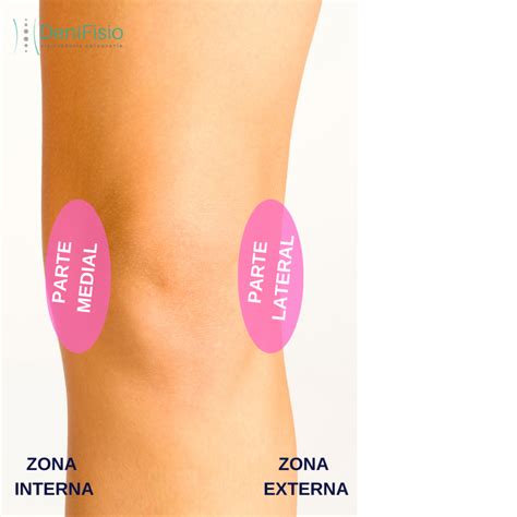 Dolor de rodilla: ¿Qué puede ser? - DeniFisio