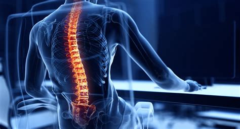 Spine and Orthopedic Center | Physical Medicine & Rehabilitation ...