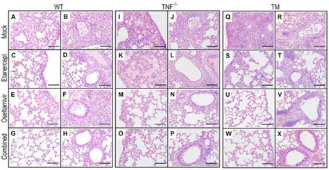 Therapeutic Targeting of Inflammation and Virus Simultaneously ...