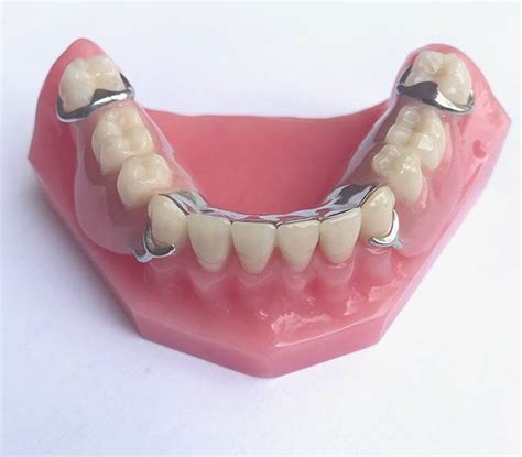 Image result for Bottom Front Teeth Partials