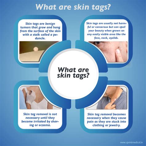 Genital Skin Tags During Pregnancy