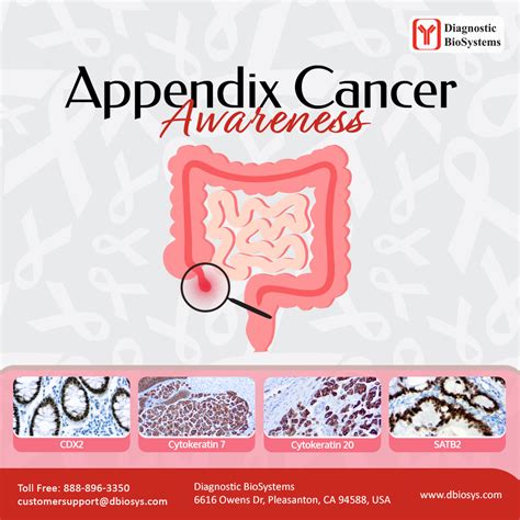 Image result for Appendix Cancer Symptoms