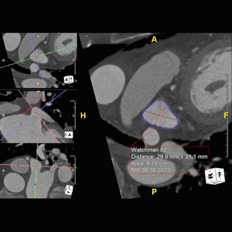 Image result for Optech Laser Watchman
