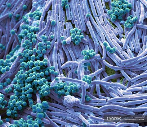 Scanning Electron Micrograph 的图像结果