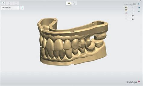 Image result for 3Shape Software