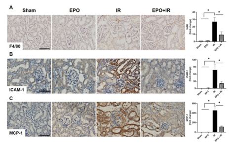 Erythropoietin Ameliorates Ischemia/Reperfusion-Induced Acute Kidney ...