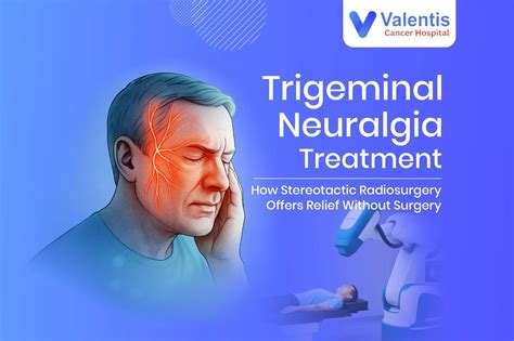 Trigeminal Neuralgia Treatment: How Stereotactic Radiosurgery Offers Relief Without Surgery