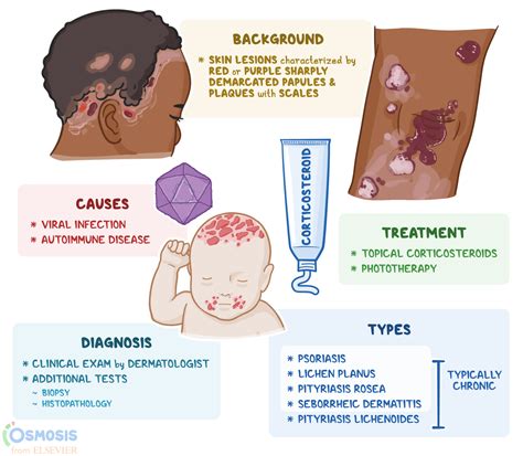 Mayo Clinic Lichen Planus