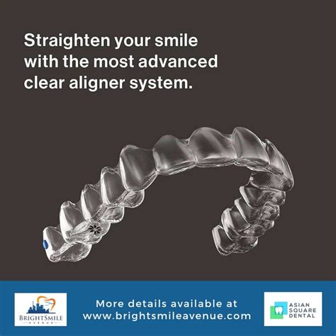 Image result for Invisalign Process