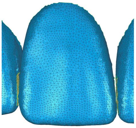 Computerized Optical Impression Making of Fully Dentate Upper and Lower ...