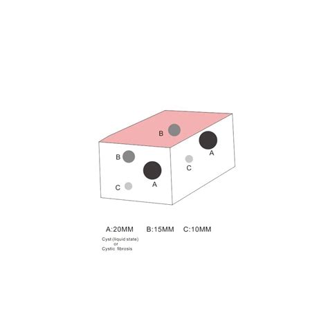SZEMENTMD Ultrasound Puncture Model Abdominal Practice kit India | Ubuy