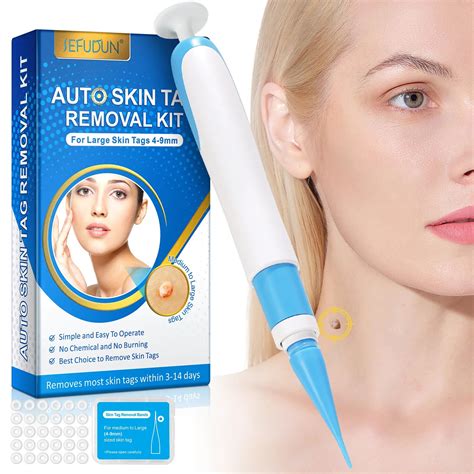 Does It Hurt to Cut a Skin Tag Off? Freeze vs Acid Truth – KentDO™ Healthy & Beauty