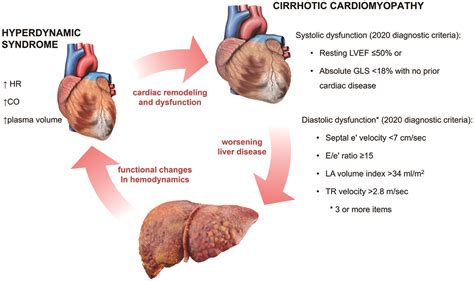 Postnecrotic Cirrhosis