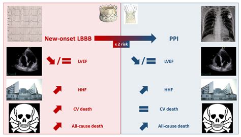 Unmet Needs in Transcatheter Aortic Valve Replacement | Encyclopedia MDPI