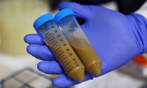 Faecal matter transplant beneficial in cirrhosis patients