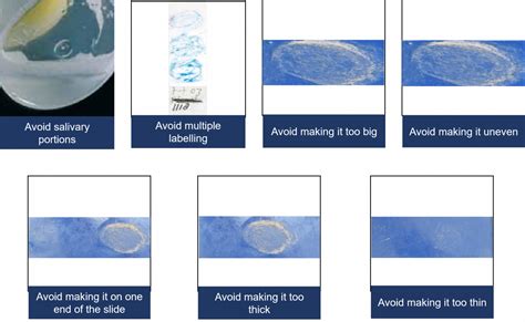 Qualities of a good sputum smear | Knowledge Base