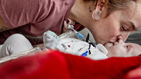 How 2 Families Faced a Catastrophic Birth Defect - The New York Times