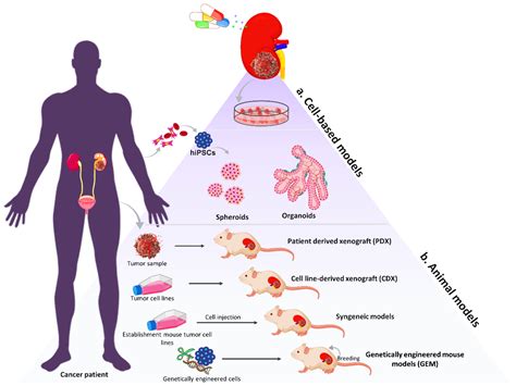 Best Renal Cell Carcinoma Treatment Center at Kathleen Swenson blog