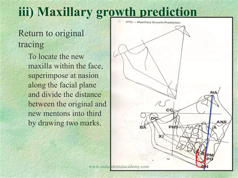 Image result for Vto Core Target