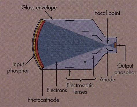 Image result for Conventional Fluoroscopy