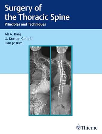 Surgery of the Thoracic Spine: Principles and Techniques eBook : Baaj ...